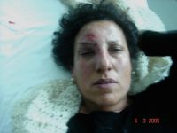 Radhia Nasrawi slik hun så ut etter møtet med tunisisk politi.